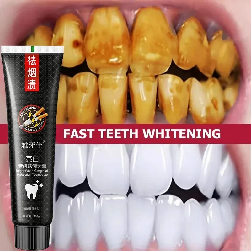 Fast Remove Smoke Stains Toothpaste Remove Plaque Stains Oral Hygiene Cleaning Fresh Breath Teeth Whiten Tools Oral Health Care