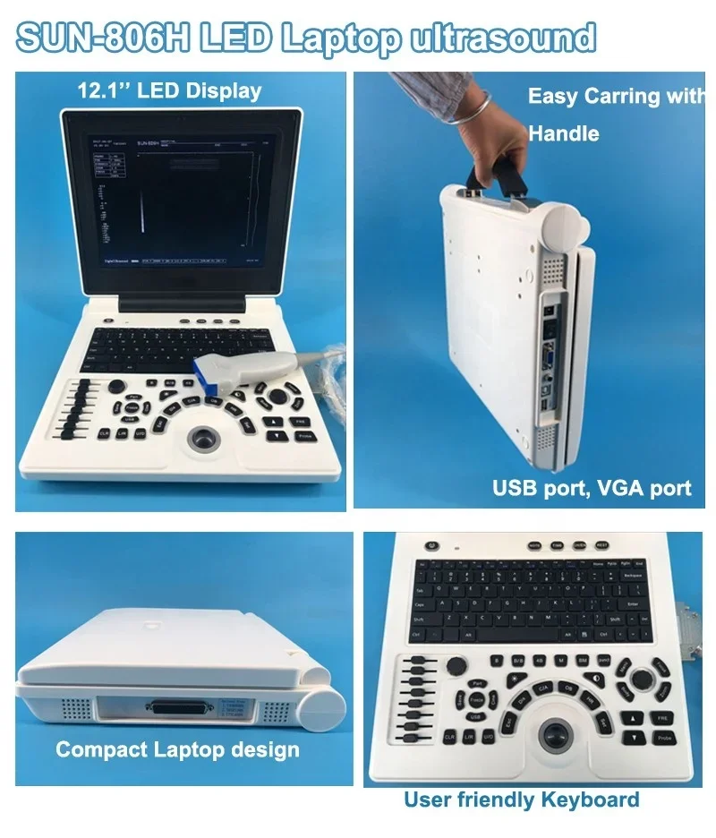 sonosite m turbo ultrasound machine with 2 Probe Connectors