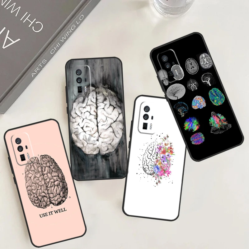 Anatomy Brain Case For POCO F5 X6 M6 Pro X3 X4 X5 F3 F4 M5s Xiaomi Mi 13 14 13T Pro 11T 12T 12 Lite Cover