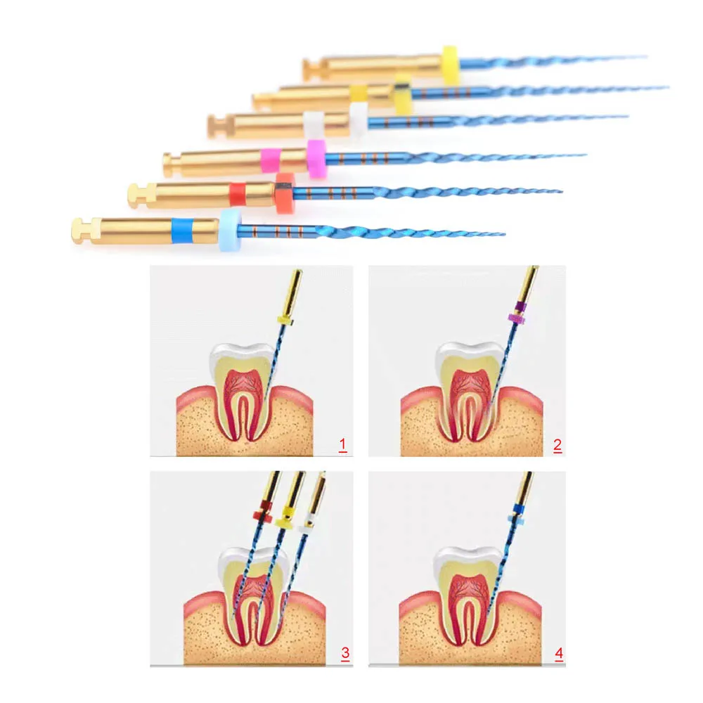 6 sztuk/pudło Dental SX-F3 niebieskie pliki aktywowane ciepłem NiTi pliki korzeniowe kanałowe mogą zgiąć pilnik do leczenia endodontycznego 21mm/25mm