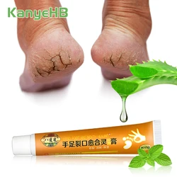 1pcs Chapped Heel Skin Repair Cream Heel Exfoliate Ointment Hand Feet Skin Anti Drying Moisturizing Repair Skin Care Cream S012