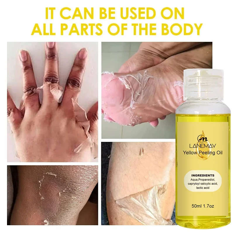 Aceite exfoliante amarillo para el cuidado de la piel muerta, suero blanqueador de melanina para brazos, rodillas y piernas, exfoliante para iluminar el cuerpo