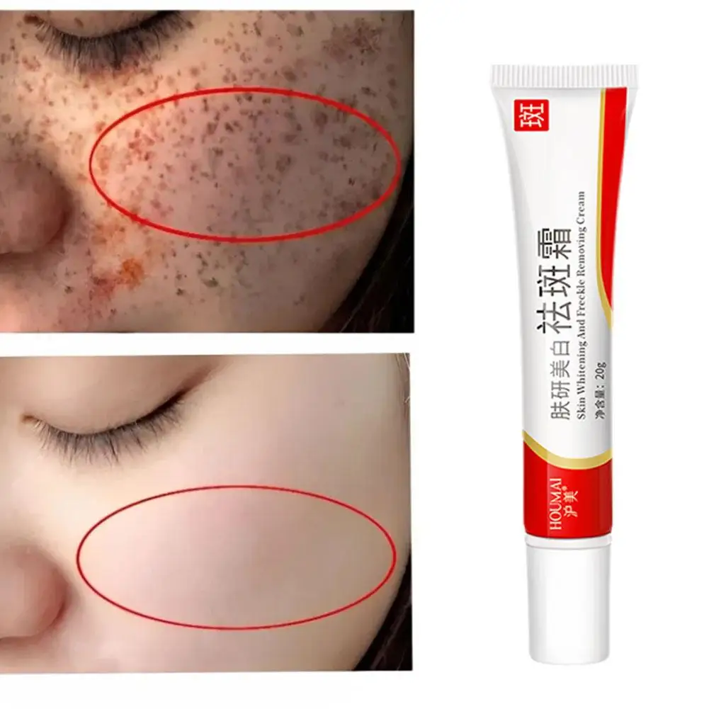 20g Whitening Freckle Cream Remove Dark Spots Anti Creams Face Care Pigmentation Brighten Skin Niacinamide Freckle Fade Mel Y2c9