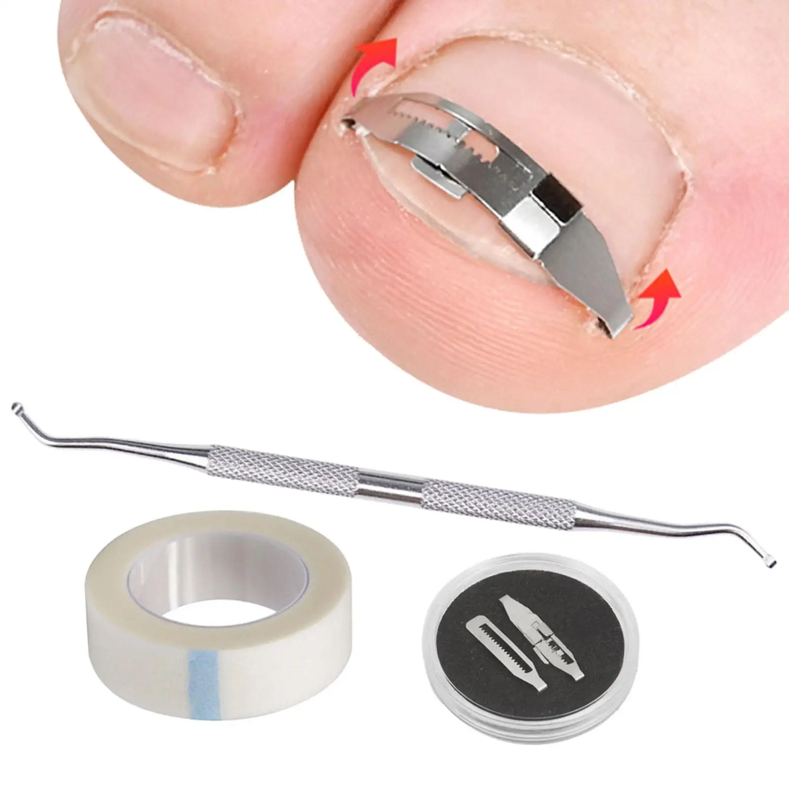 Toenail Correction Strips Adjustable Ingrown Nail Treatment Set Carbon Steel Beauty Tool for Women Foot Health