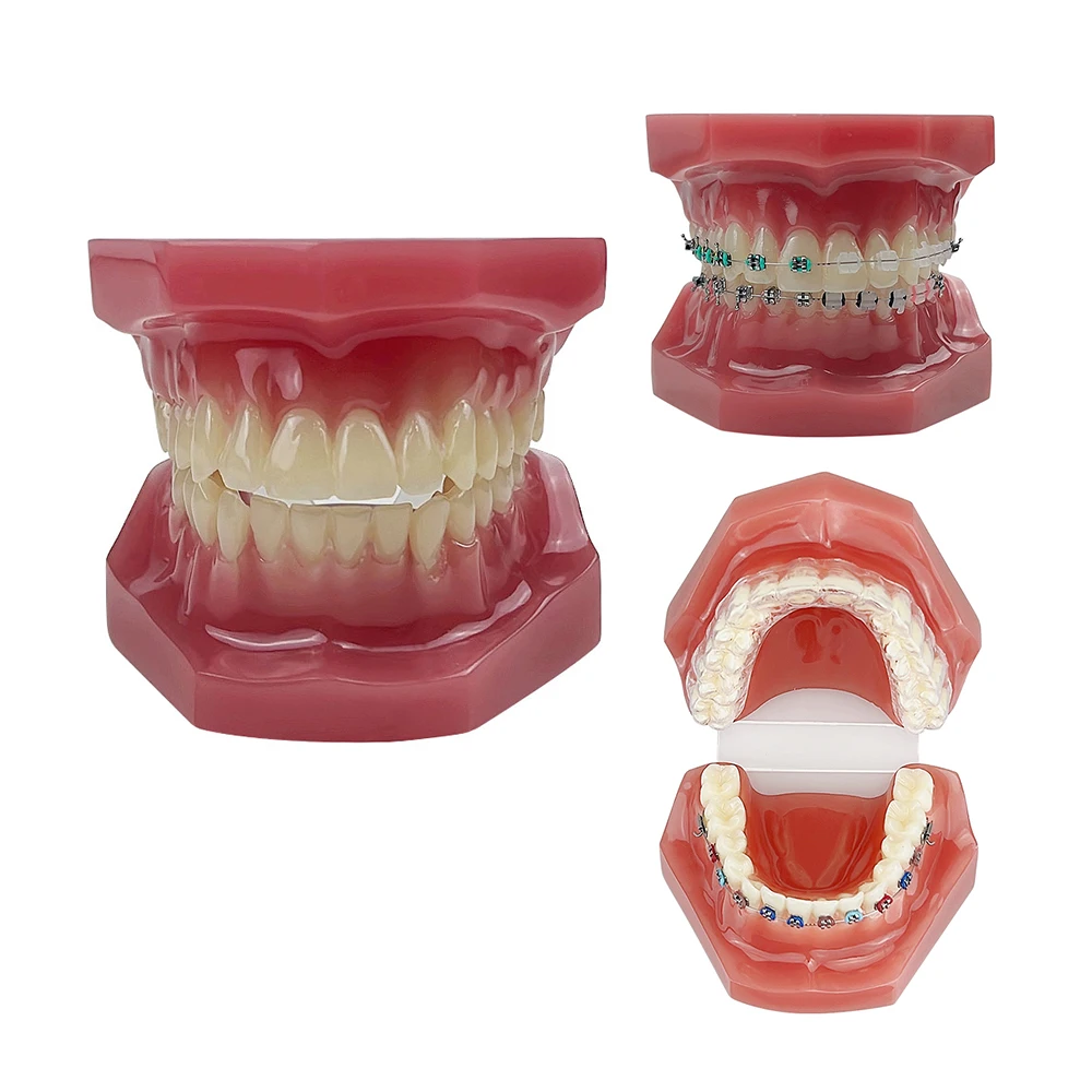 Model nauczania ortodontycznego Model ustny pół ceramiczny pół wspornik metalowy do narzędzia komunikacji lekarz-pacjent dentysty