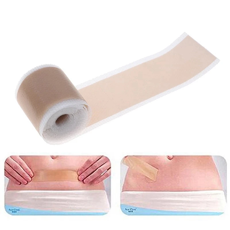 3PC efficiente chirurgia rimozione della cicatrice Gel di Silicone Patch per terapia del foglio per il trattamento della cicatrice per la riparazione della pelle della cicatrice da ustioni da Trauma dell'acne