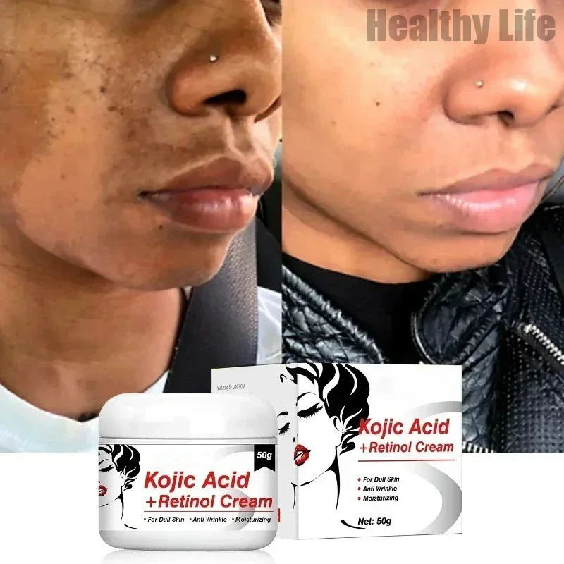 

Women Skin Brighten Cream Kojic Acid Retinol Cream Quickly Fade Melasma Cream Fade Fine Lines Brightening Moisturizing Skin Care