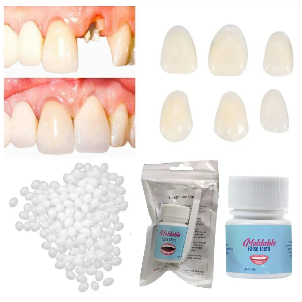 20g Temporary Tooth Repair Kit Teeth And Beauty Teeth To Adhesive Gaps Solid Teeth Whitening False Denture Tooth C8Q9