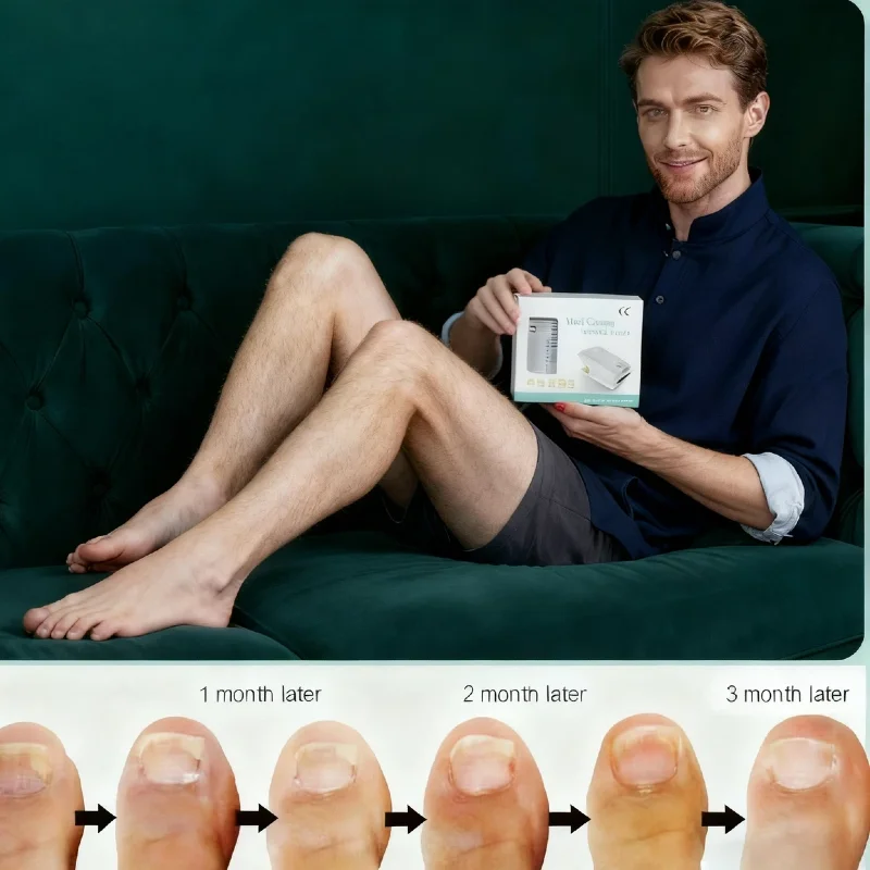 

Fungal Nail Laser Treatment Device, 905nm 470nm Nail Fungus Therapy for Onychomycosis Cure on Fingernails and Toenails