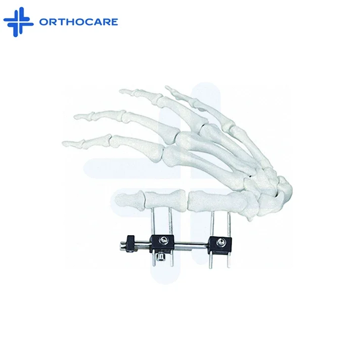 Ortho Fixation System Micro Fixator External   Instrument Materials&Artificial Organs ORTHOCARE OEM