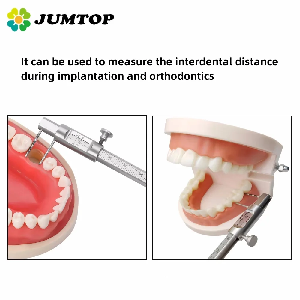 

JUMTOP Dental Caliper - 0-80mm Orthodontic & Implant Measuring Gauge for Precision Dentistry & Surgical Planning