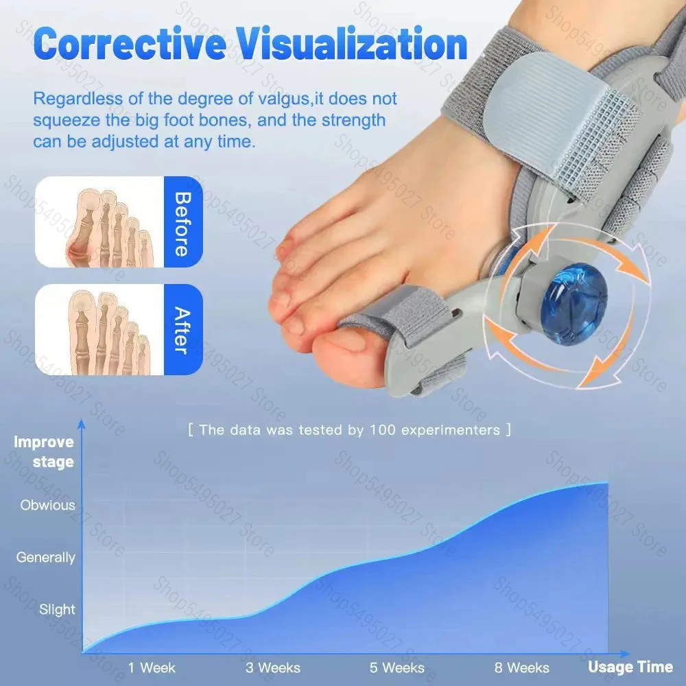 Bunion 교정기 조절식 무지외반증 엄지 발가락 교정기 회전식 발가락 교정기 조정 가능한 발가락 교정