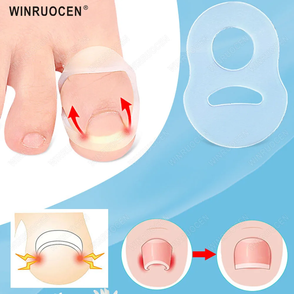 1pcs Silicone Ingrown Toenail Ring Ingrown Toenail Treatment Correction Tool Paronychia Treatment Corrector Pain Relief