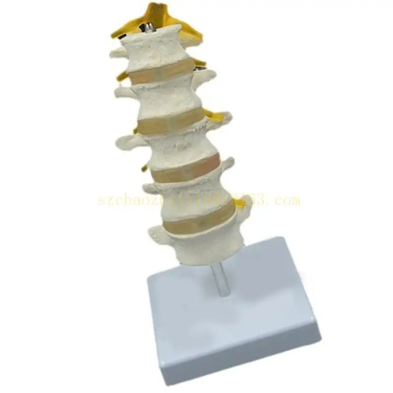 

62KA Realistic Lumbar Spine Anatomy Model Showing Intervertebral Discs and Spinal Nerves for Clinical Demonstration Education