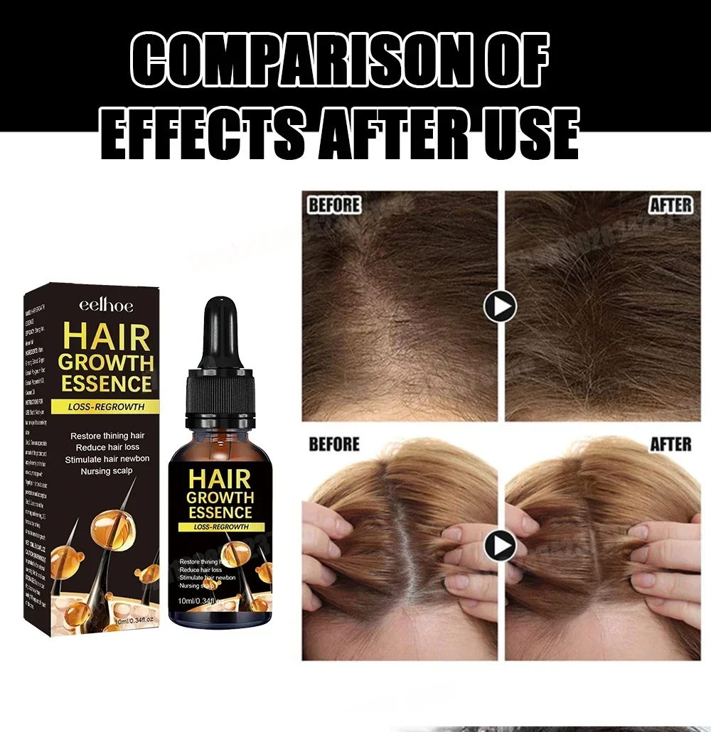 نمو الشعر للرجال والنساء، منتجات سريعة النمو، الزيوت الأساسية، الزنجبيل المضادة لتساقط الشعر، فروة الرأس، العناية بالشعر