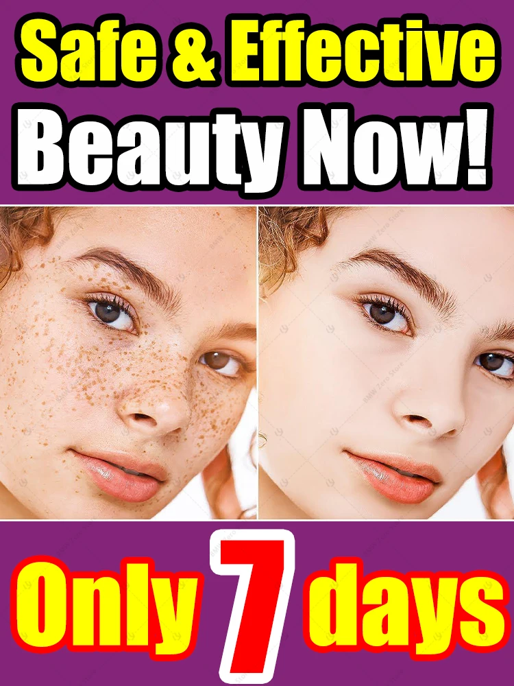 

Powerful Cream Dissolve Black Spots on the Face