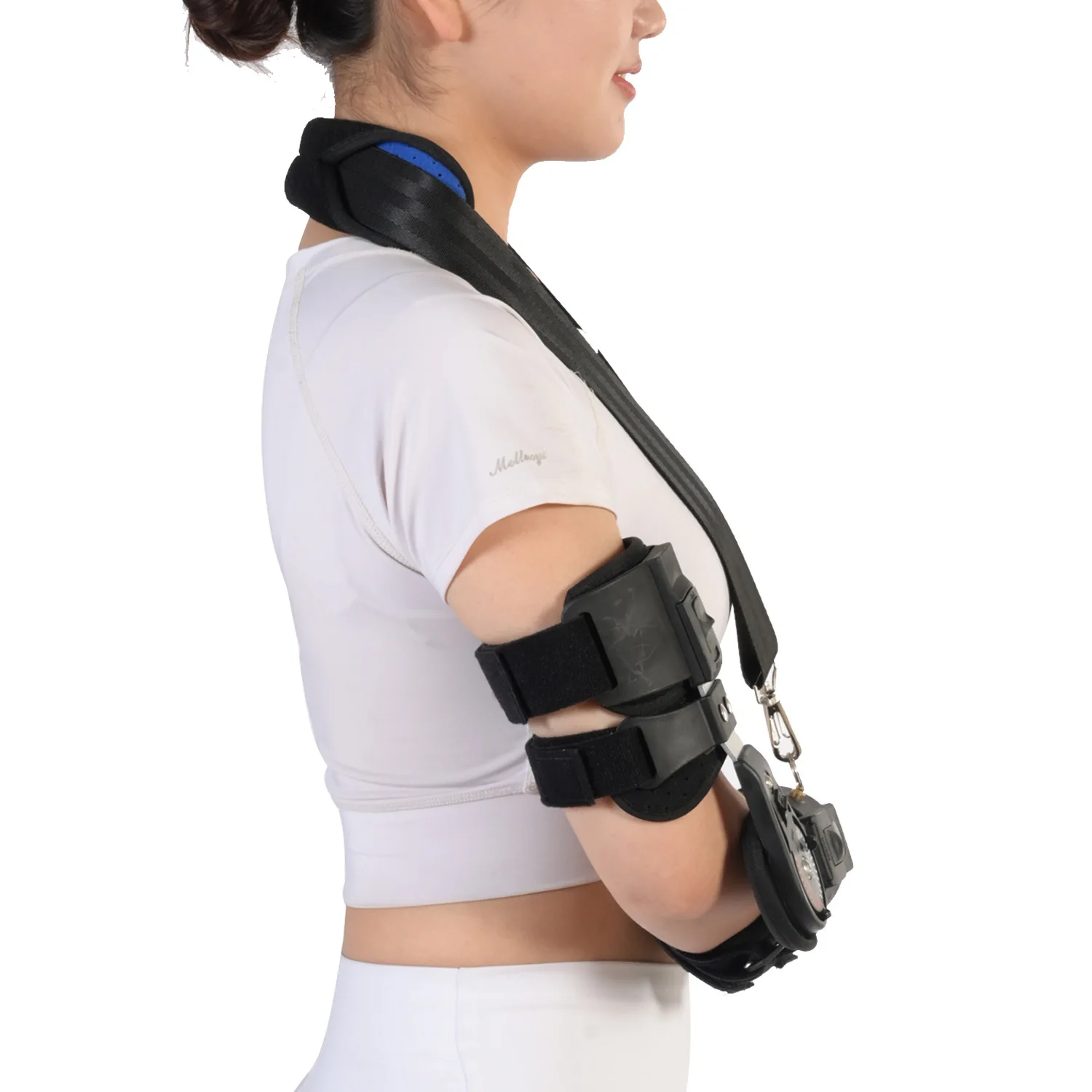 Рисунок 5 - Фиксация локтевого сустава