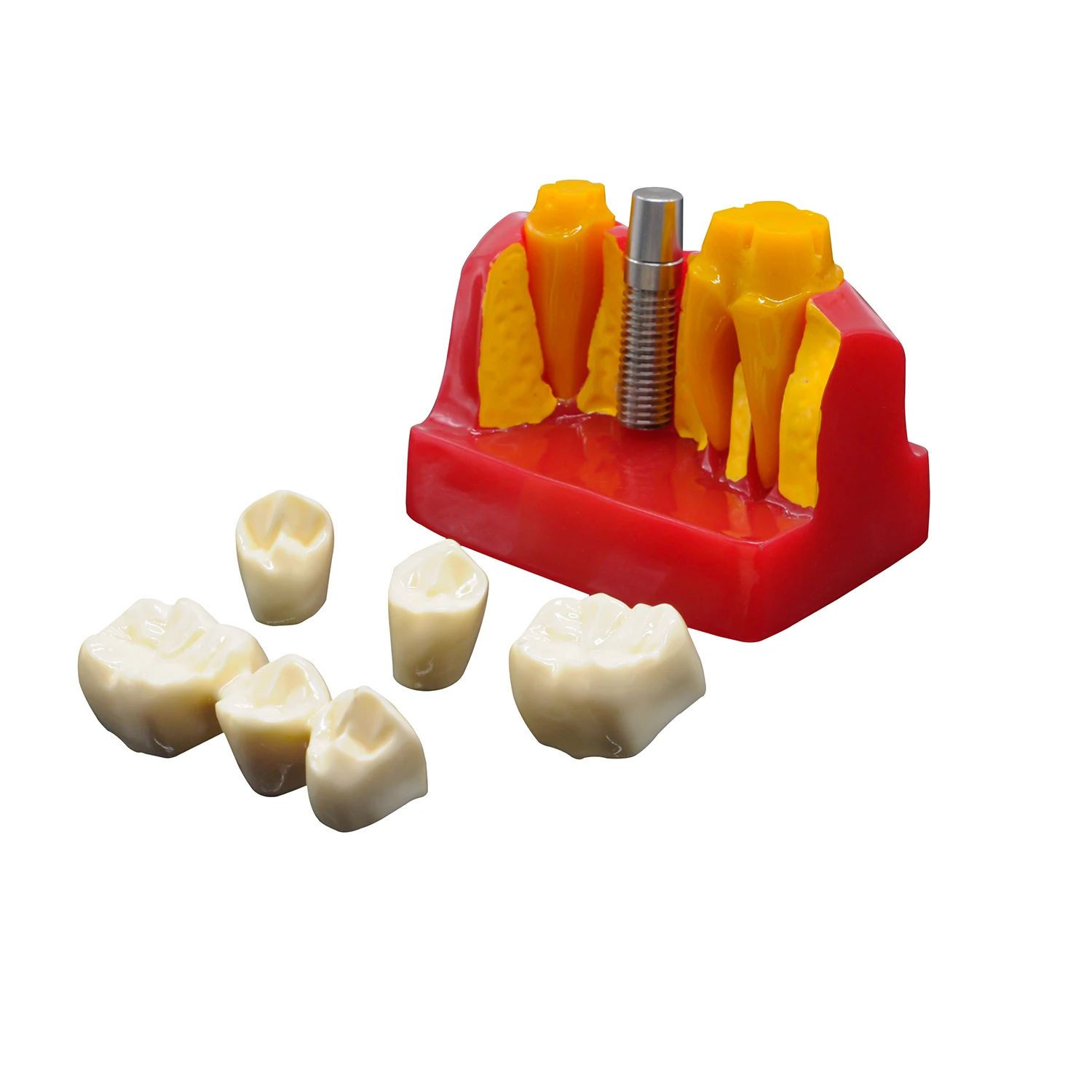 Dental Implant Analysis Model Crown Bridge 4 Times Implant Demonstration Removable Dentist Lab Teaching Models Tools