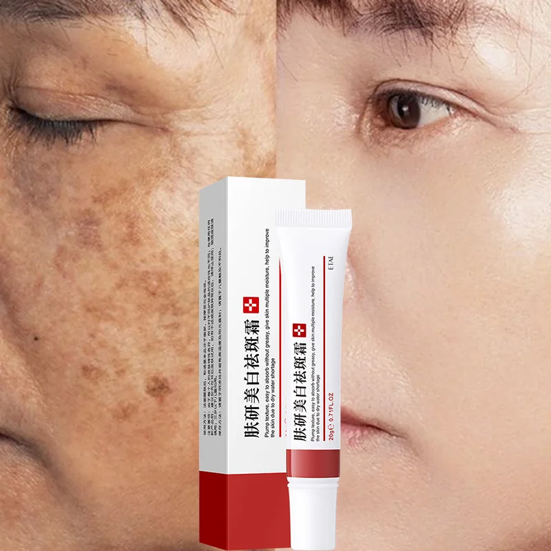 

Whitening Freckle Cream Remove Melasma Cream Remove Dark Spots Melanin Melasma Remover Brighten Skin Anti-Aging Skin Lightening