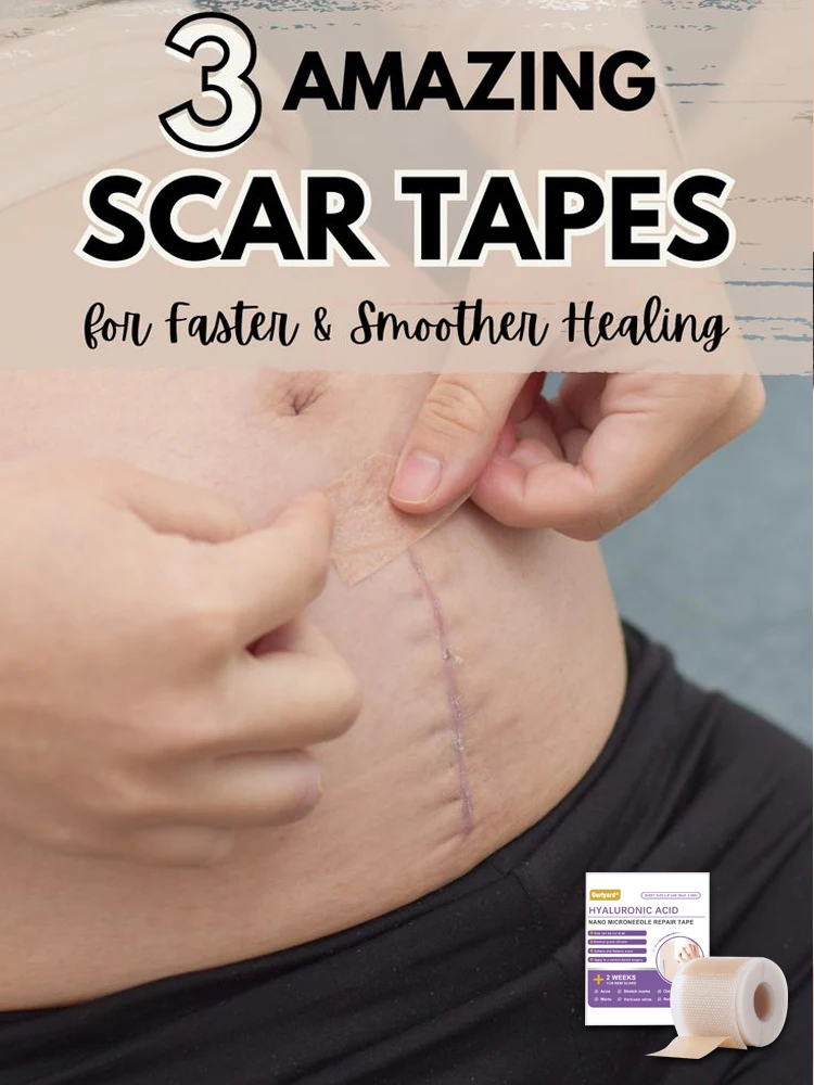 1 Roll Silicone Scar Sheets , 4cmX150cm Self-Adhesive Scar Cover Tape Reusable and Effective Skin Care Strips