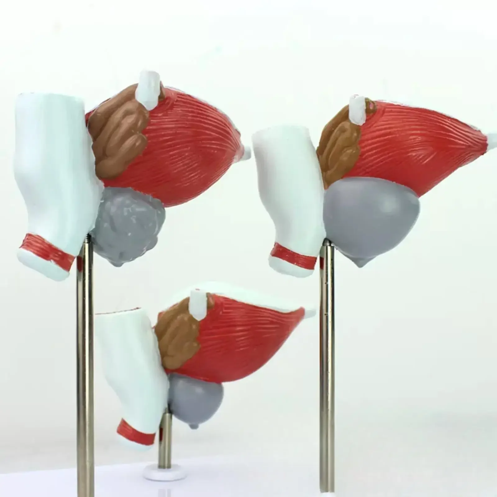 PVC Human Prostate Normal Hyperplasia Carcinoma Model Medical Teaching Models