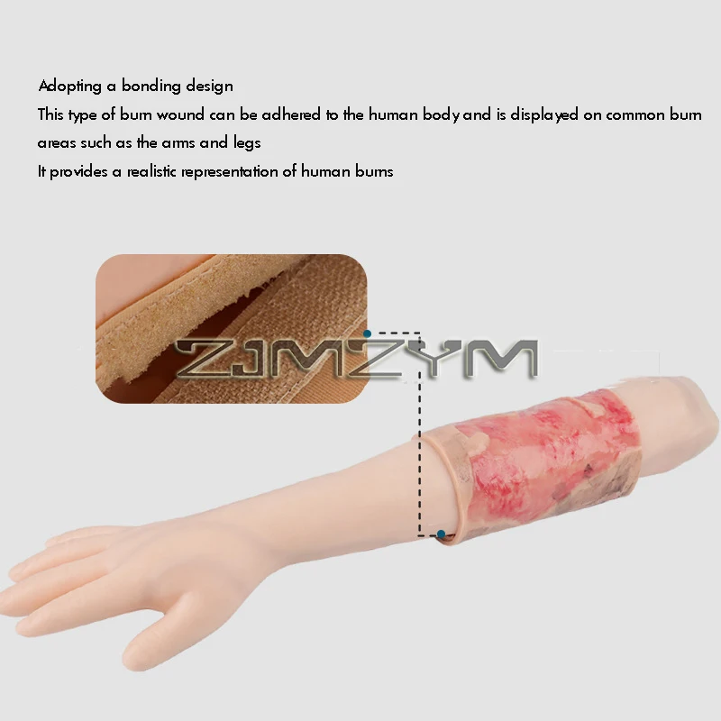 Wearable 2-3 Degree Limb Burns Training Module High Simulation Limb Burn Model Medical Student Nurse Training Model