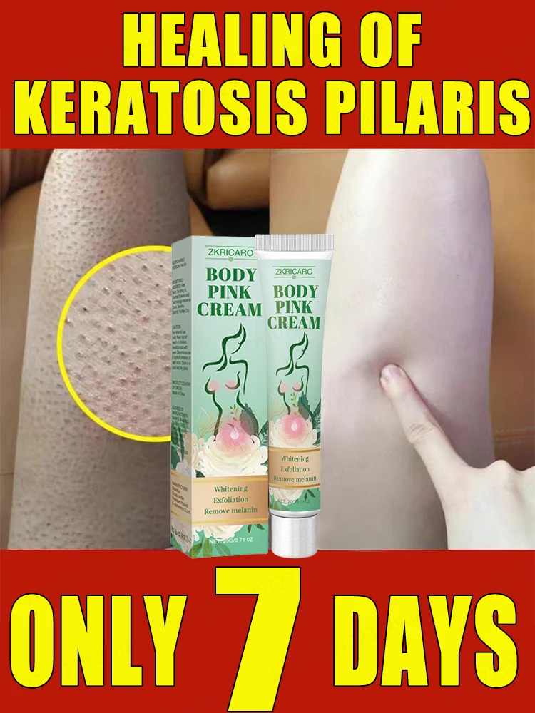 Exfoliating body lotion, repairs keratosis pilaris, removes goosebumps and strawberry legs