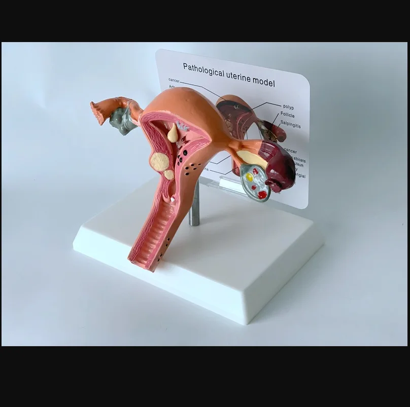 

Женская патологическая матка, яичник, анатомическая модель, медицинский обучающий реквизит для биологических заболеваний и медицинского развития