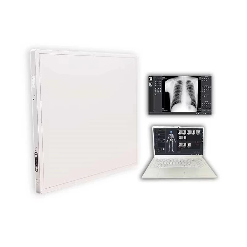 Wireless Digital Flat Panel Detector for Veterinary X-Ray Machine Hospital and Clinic Use