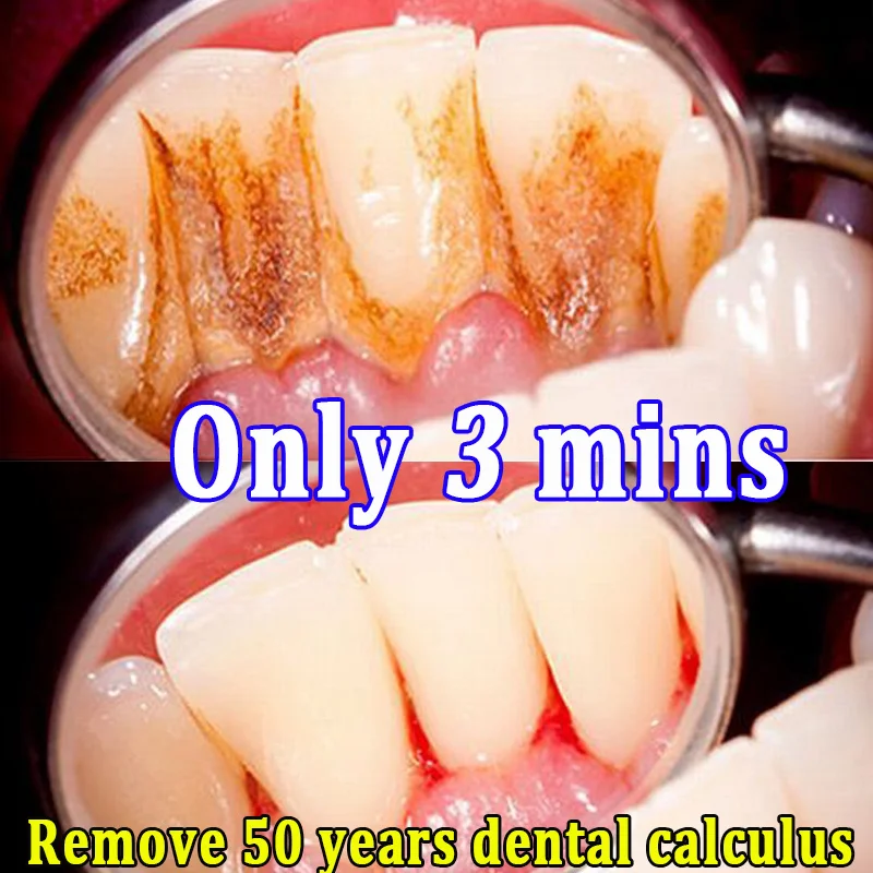 

90% of users said it solved their dental problems.