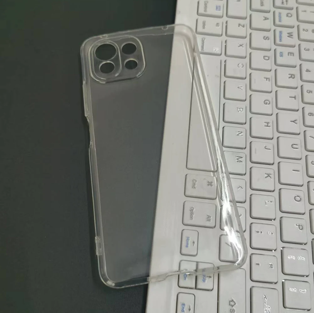 For Xiaomi 11 Ultra… - image