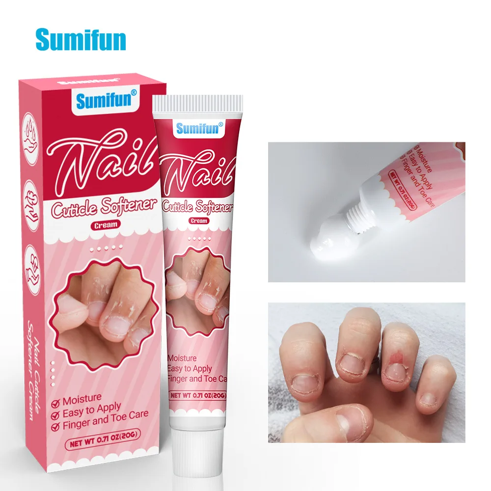 Sumifun Nail dead skin ointment finger barb repair cream nail