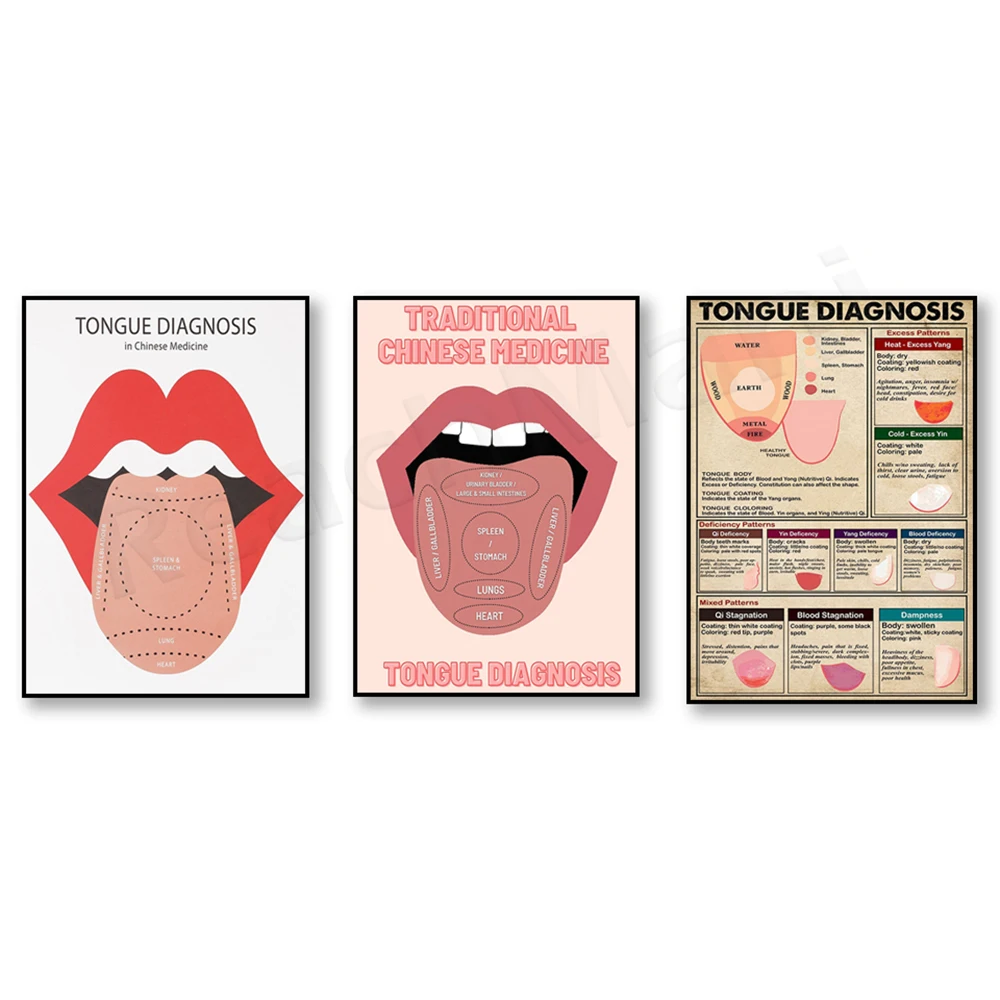 TCM Study Guide Tongue Diagnosis Poster - Acupuncture Art Print Alternative Medicine Healing Visual Guide Gift