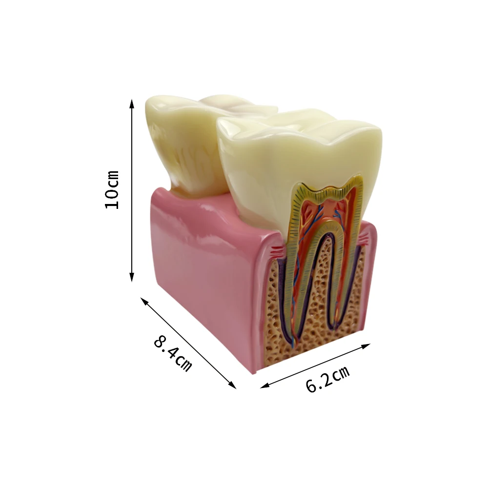 Large Comparation Teeth Model Study Anatomy Models Denture Tooth Decay Model For Dentist Learn Researching Demo Patient Clinic