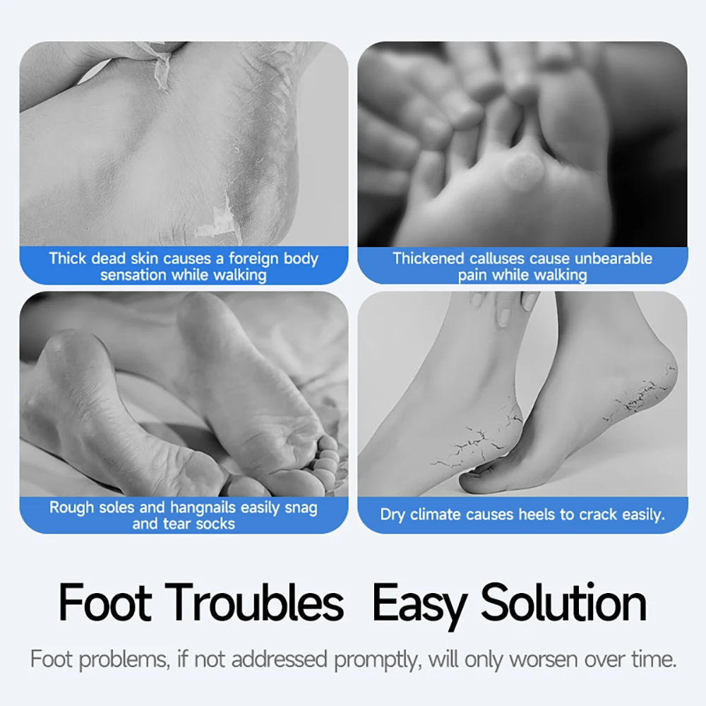 مطحنة مسامير القدم الكهربائية القابلة لإعادة الشحن، أدوات باديكير جمالية محسنة مدمجة، تصميم دوار جديد بحواف نظيفة #4