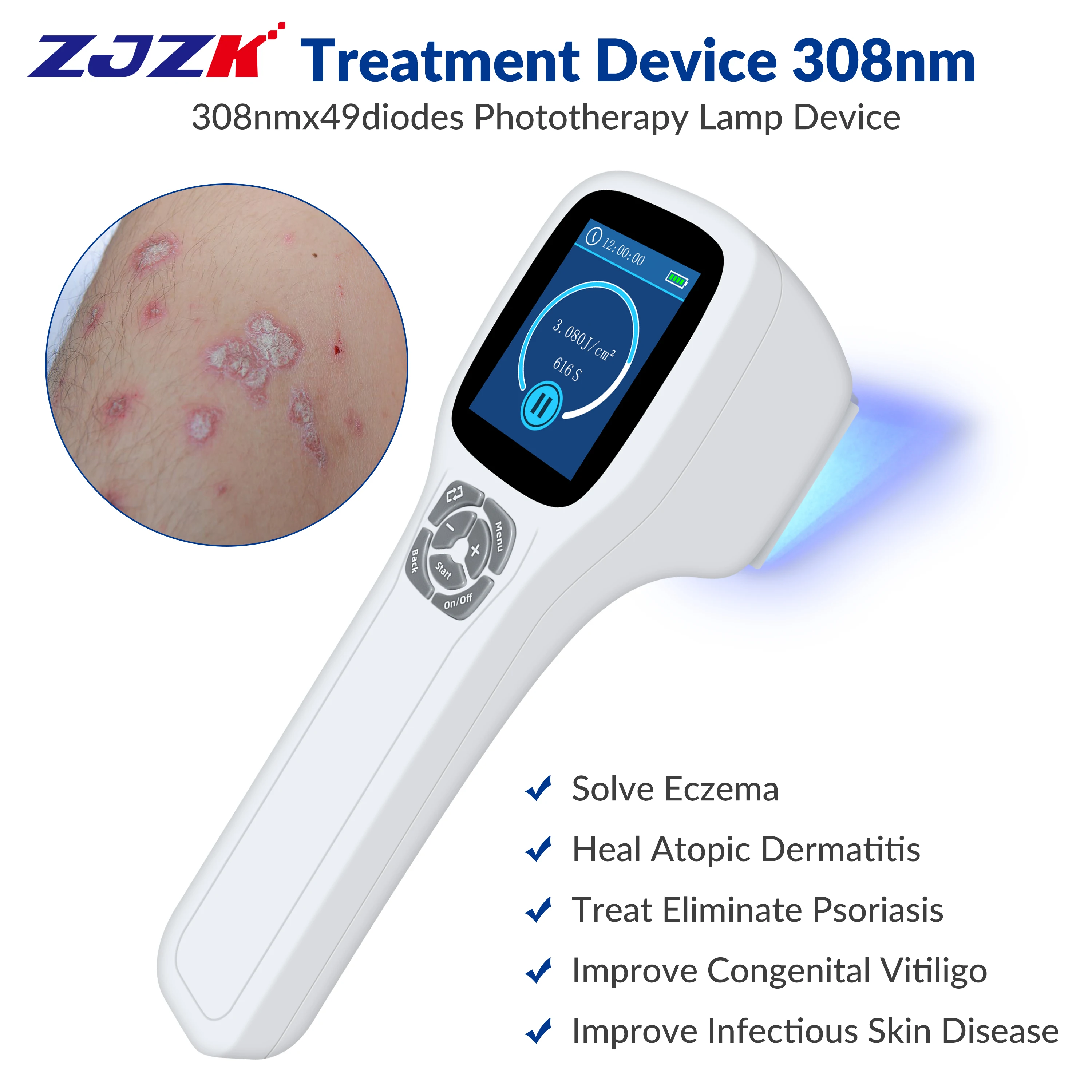 ZJZK Box Dermatology UV Light Therapy For Skin Conditions 308nmx49diodes Blue Light Therapy Rosacea Before And After Dermatitis