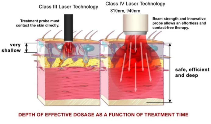 2025 High Power Class 4 Laser Therapy Veterinary Device Deep Tissue Pain Relief Physical Therapy Equipment for Animals