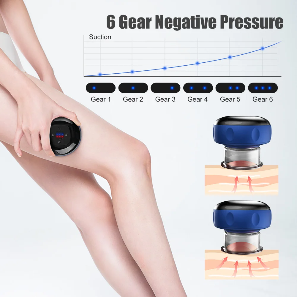 USB Smart Electric Vacuum Cupping Device Body Scraping Massager Heating Suction Cup Device Physical Fatigue Relief Beauty Health