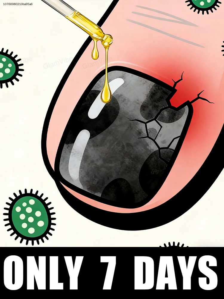 

Снижите уровень тревоги и перестаньте постоянно беспокоиться о ногтях.