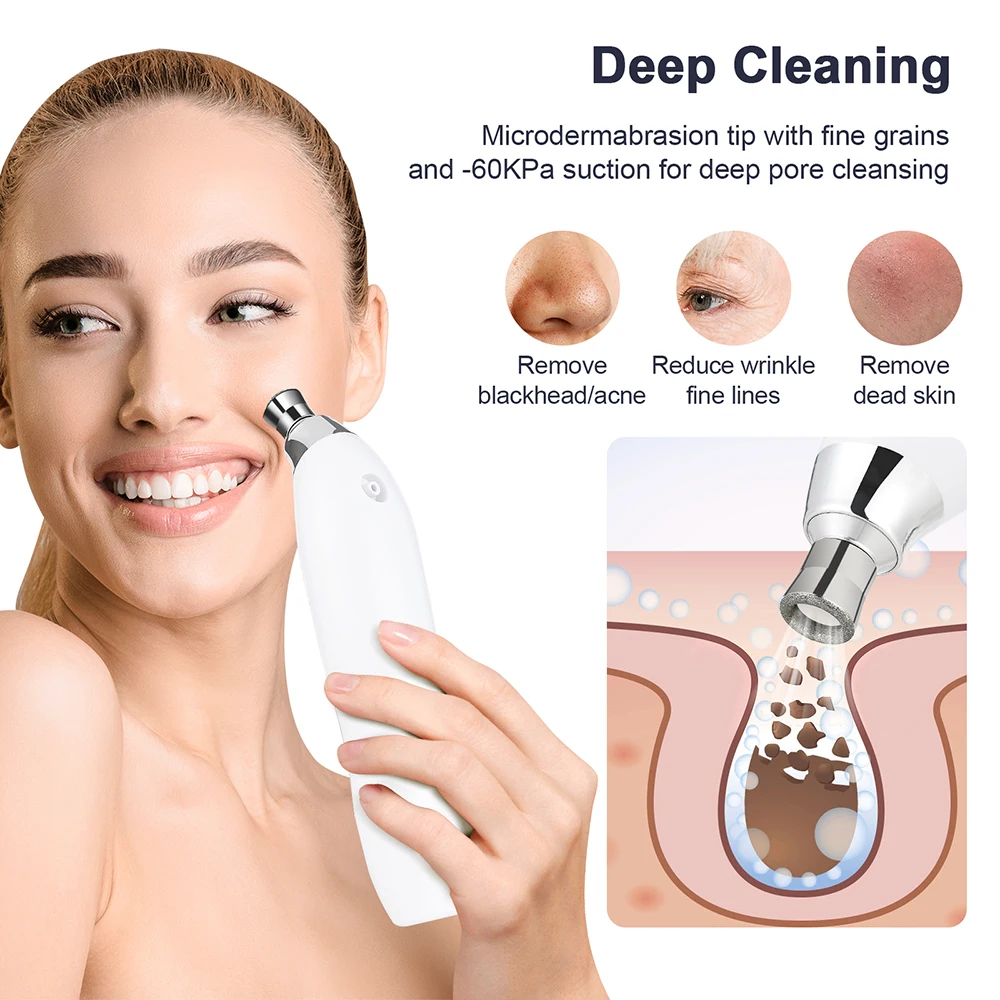 Máquina de microdermoabrasão de diamante 60kpa, potência de sucção, remoção de cravo, dispositivo profissional de limpeza profunda facial, uso doméstico