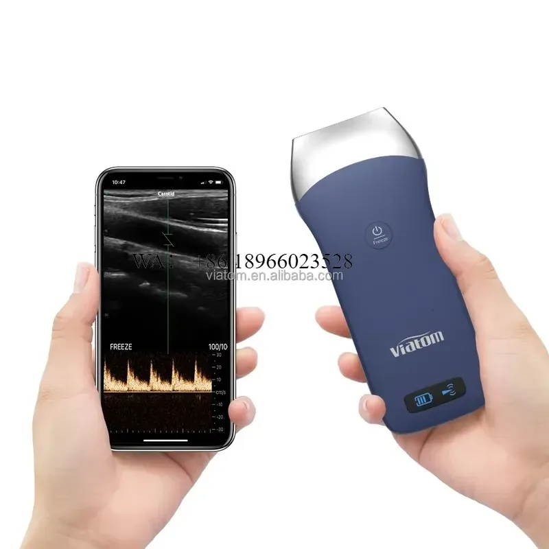 WMWMNU for Viatom 128 Elements Wireless Ultrasound Linear Probe 7.5/10MHz Handheld Portable