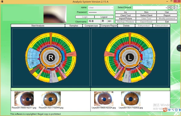 New arrival 5 MP iriscope iris analyzer/iridologie eye iris scanner