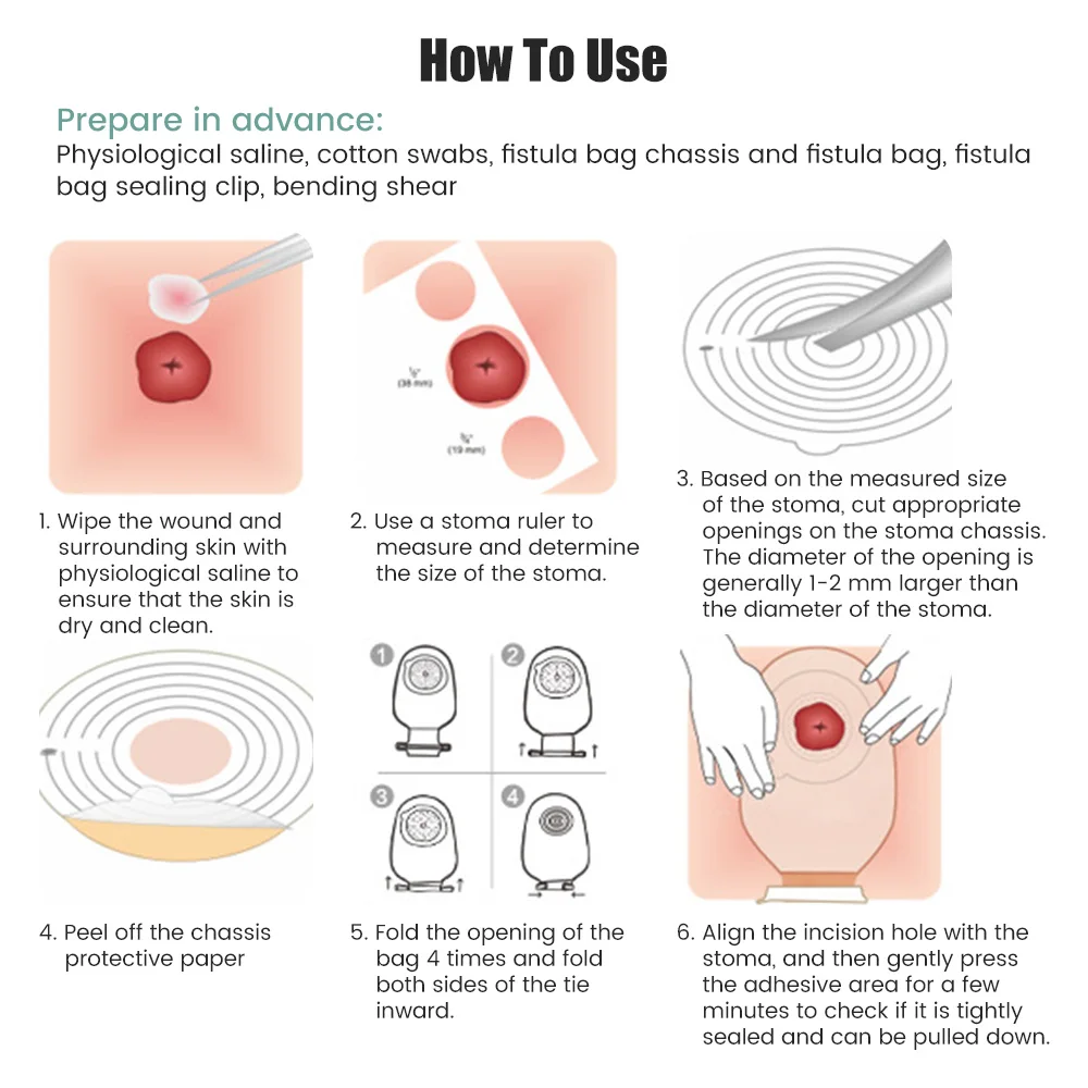 10-50 pezzi valvola di scarico sistema monopezzo sacchetti per colostomia per adulti sacchetto per colostomia usa e getta apertura 20-65mm con chiusura a clip