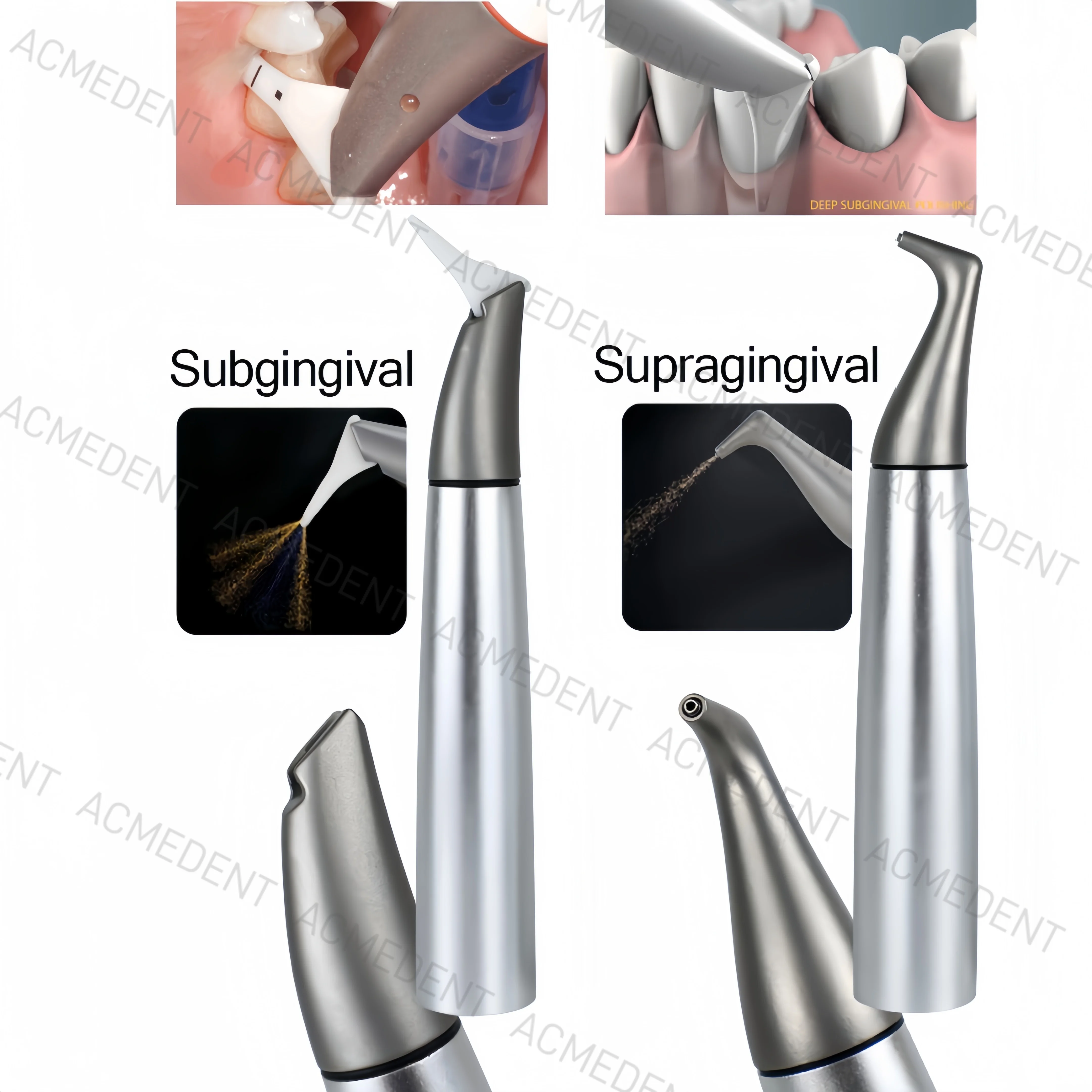 2Sizes Dental Air Flow Polisher Supragingival Subgingival Handpiece Handle Fit EMS S1 S2 MASTER OIEZON PERIO-FLOW Nozzle