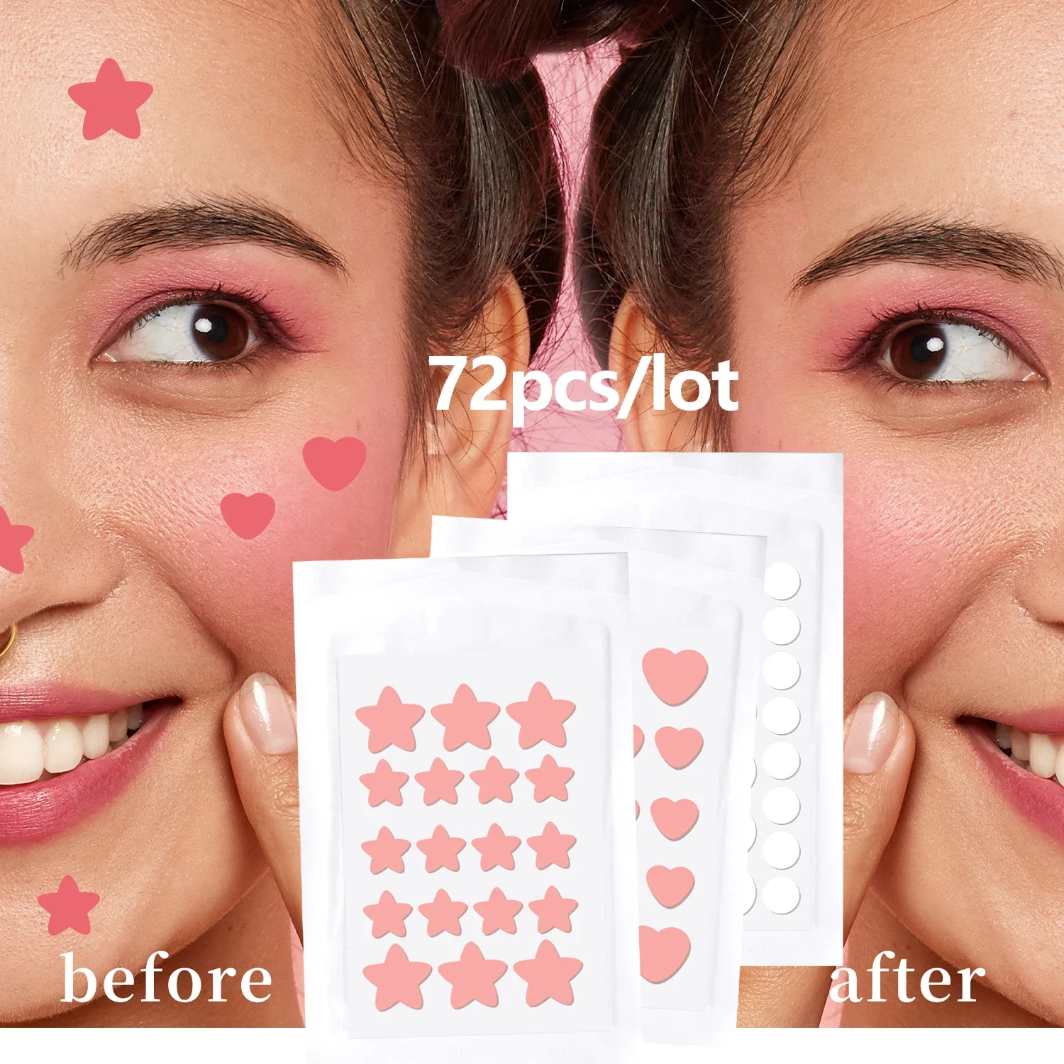 

New Acne Pimple Patch Stickers Acne Removal Waterproof Acne Treatment Pimple Remover Tool Facial Mask Skin Care 72 patches/bag