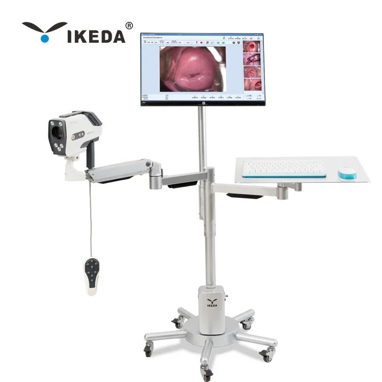 IKEDA Portable Digital Video colpos cope for Gynaecology