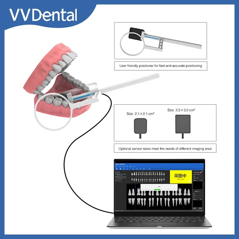 Sensor dental raio x radiovisiógrafo sensor digital sistema de imagem intraoral imagem hd equipamento odontológico com sensor posicionador