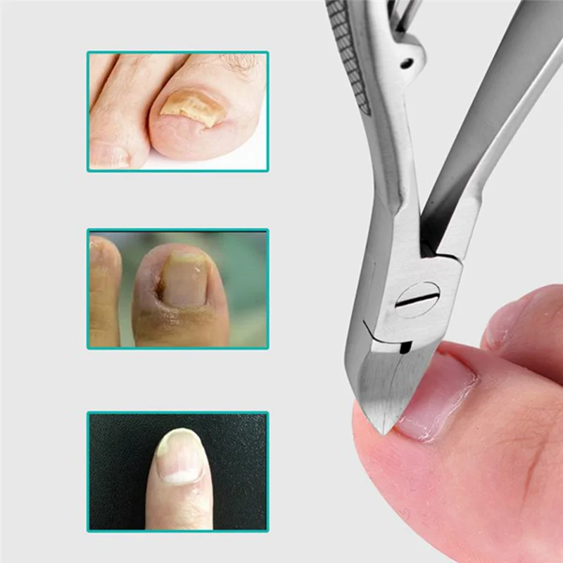 

Professional Feet Toe Nail Clippers Trimmer Cutters Paronychia Nippers Chiropody Podiatry Stainless Foot Care Tools
