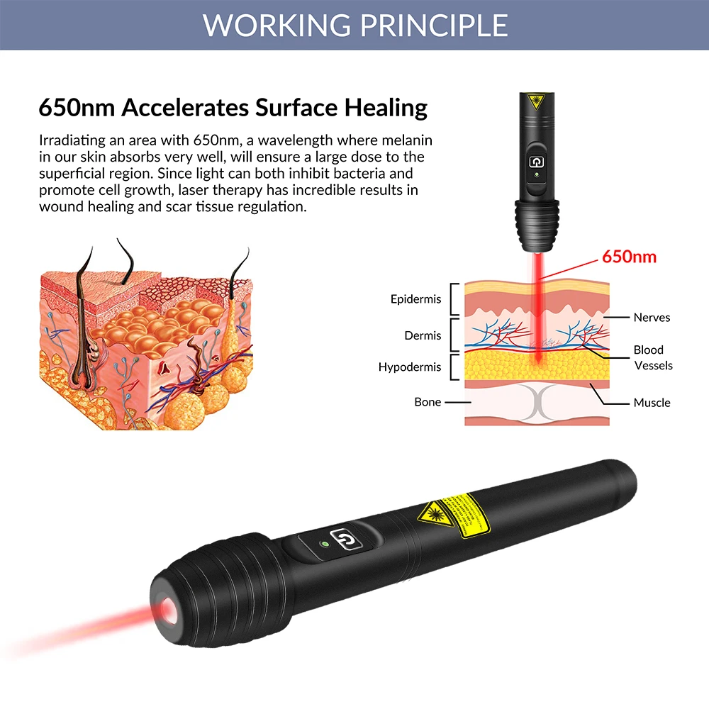 ZJKC 100 mW acupunctuurpen 650 nm LLLT rode lasertherapie voor artritis sportblessures draagbaar thuisgebruik voor wondeninfecties