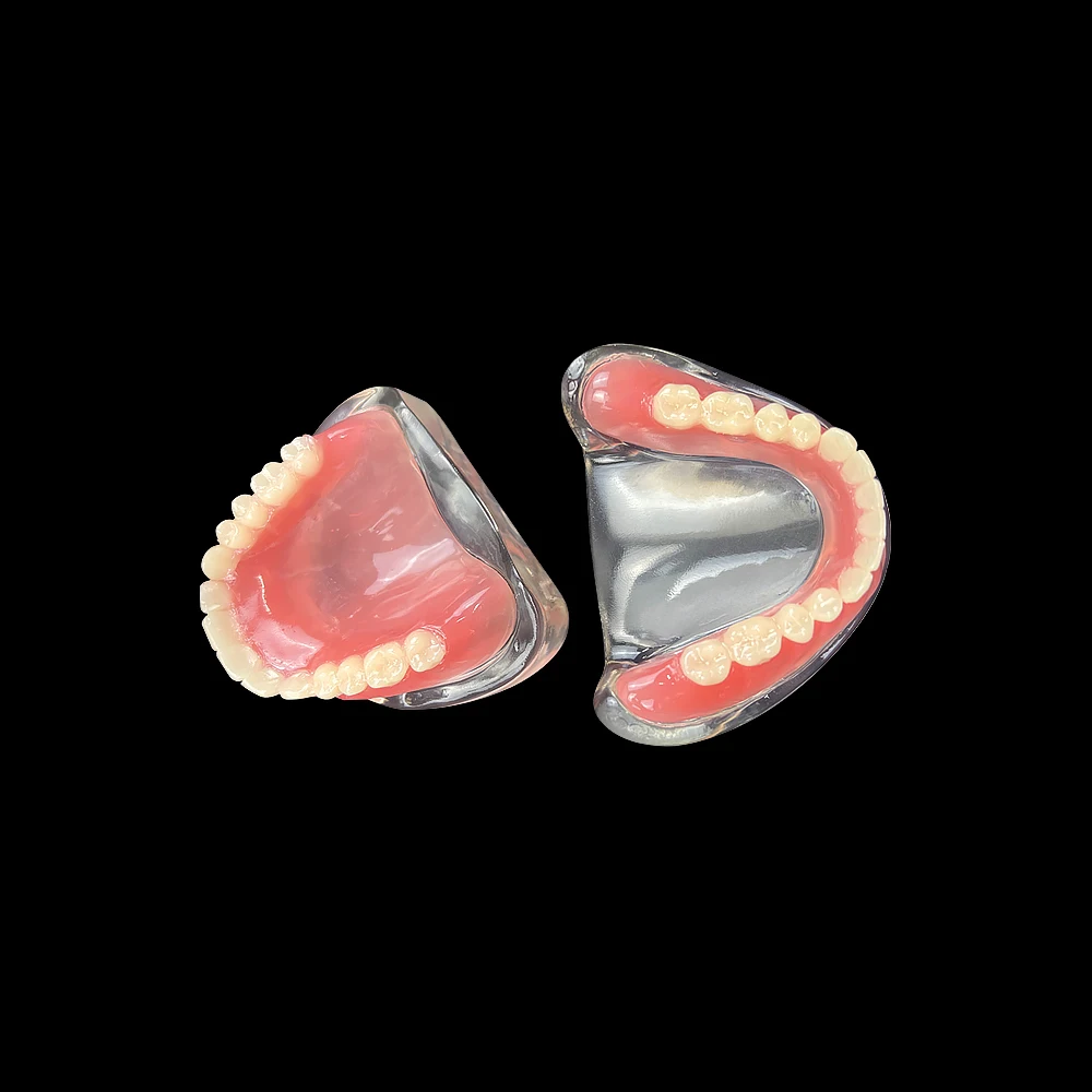 Modelo de implante Dental, producto de odontología, demostración de overdentadura Interior extraíble, mandíbula Superior e inferior con 4 implantes